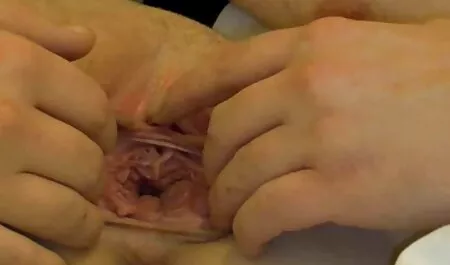 Un médecin en bas tue un video pornographique pornodingue mauvais patient